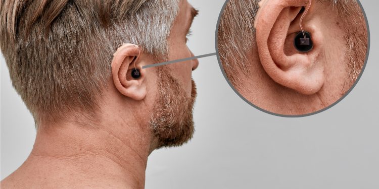 Are Audien Hearing Aids Actually Any Good?